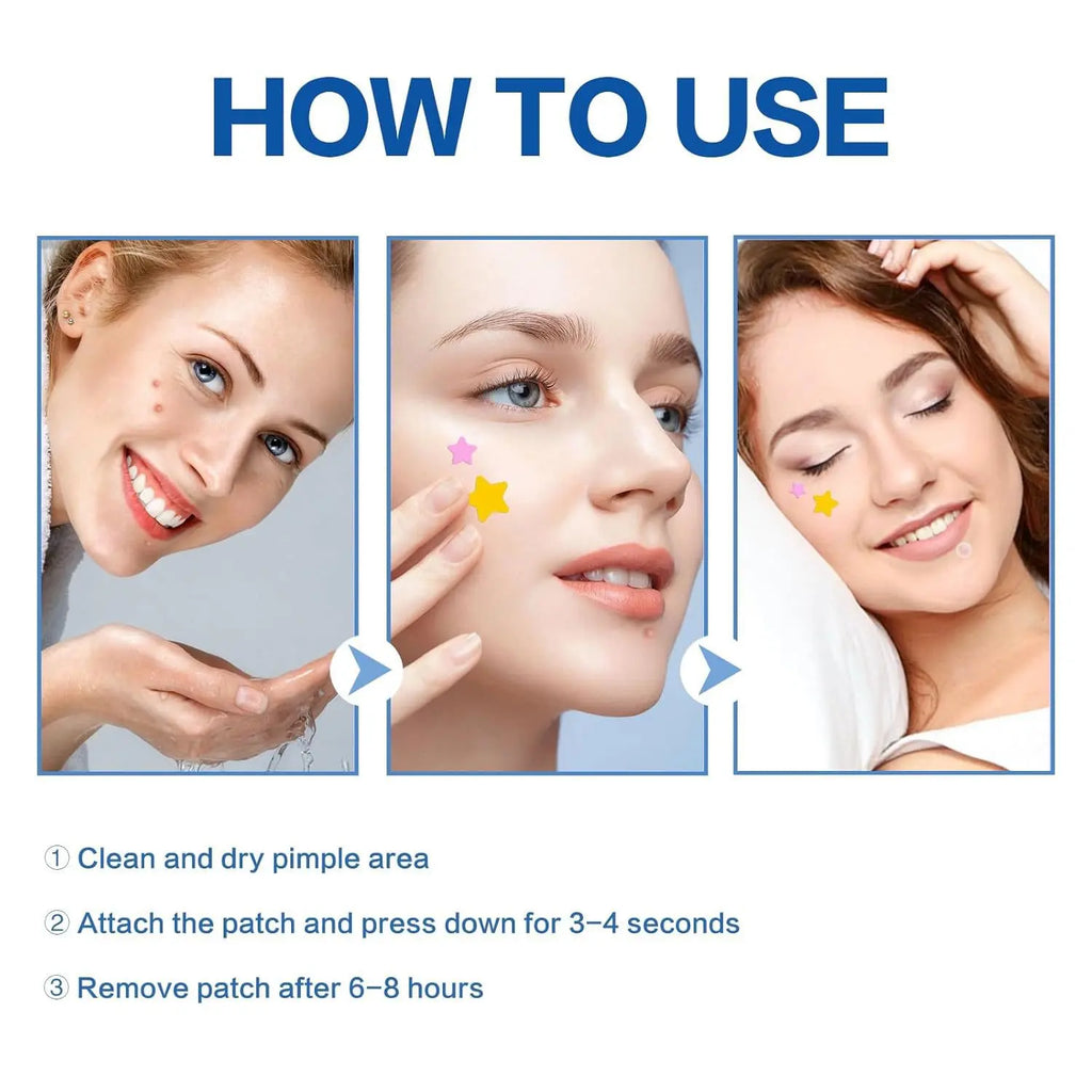560 Pcs Star Acne Stickers, Comfortable Blemish Patch, Hydrocolloid Acne Patch, Portable Facial Care, Suitable for All Occasions, 7 Colors, Makeup Essential