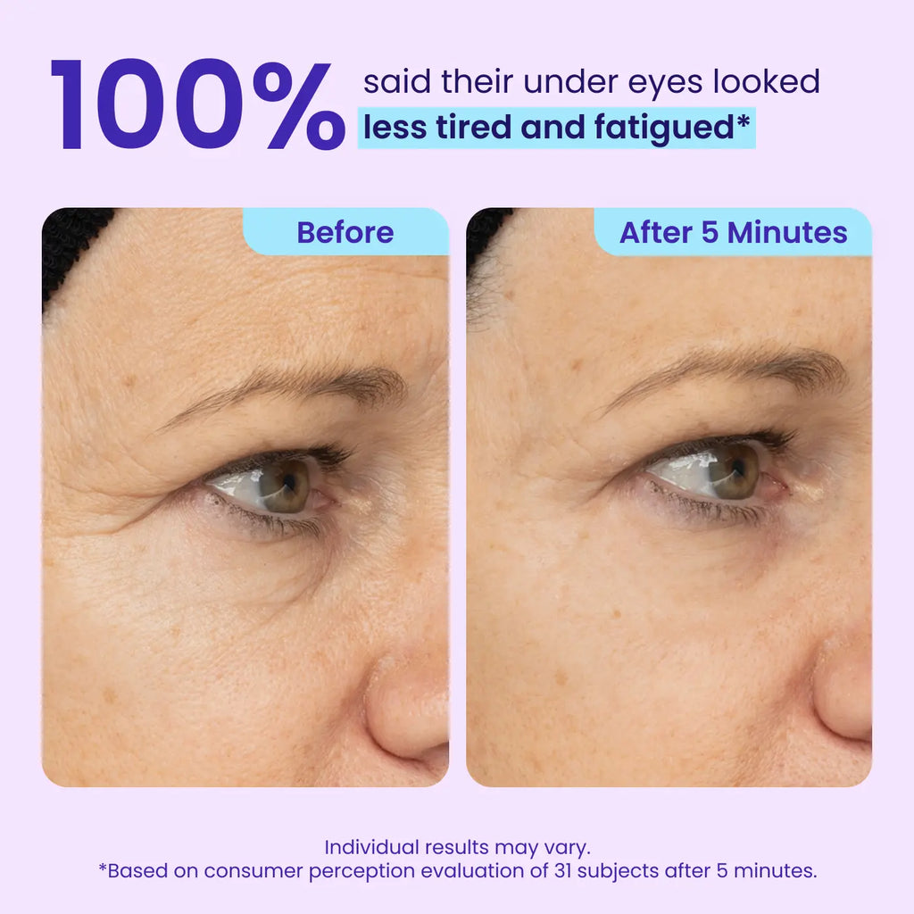 NEW! GOPURE Instant Lift Eye Gel - for the Look of Puffiness & Bags, Wrinkles, Fine Lines and Dark Circles, anti Aging Skin Care for Men & Women with Collagen Targeting Biotech under Eye Brightener